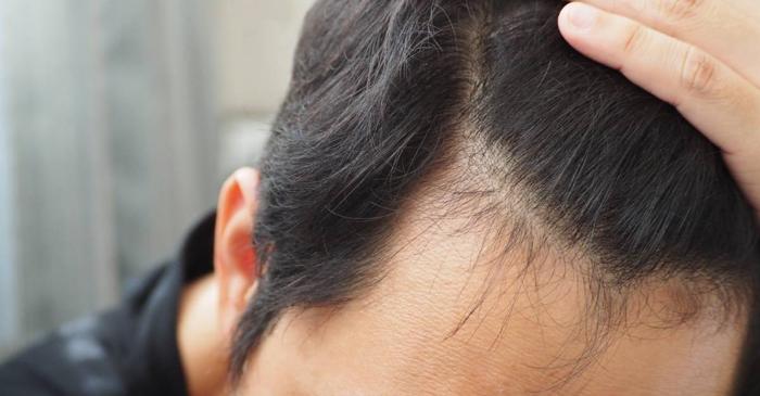 5 alimente bogate în biotină care stimulează creșterea părului