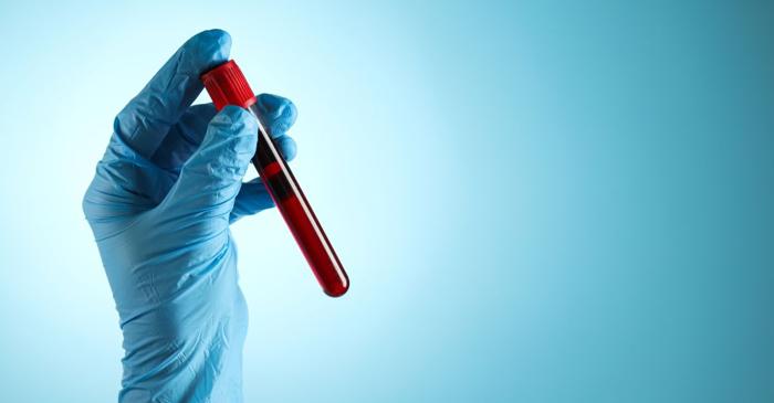 Grupa de sânge A crește riscul de accident vascular cerebral timpuriu, arată un nou studiu