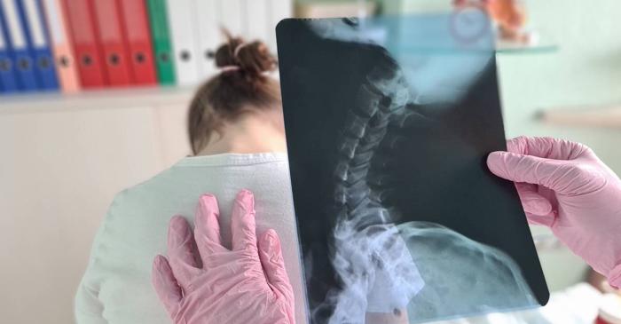 Kinetoterapia, prima linie de apărare în tratarea scoliozei la copii