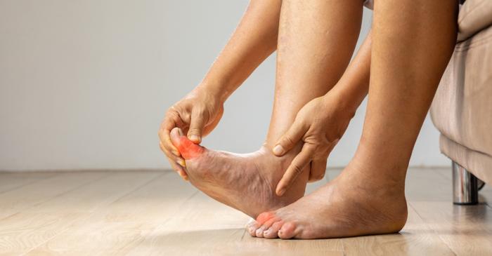 Rețetă inedită cu șampon și banane pentru combaterea ciupercilor de la picioare