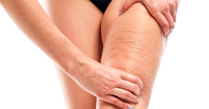 Cu ce alimente combați celulita și întărești pielea?