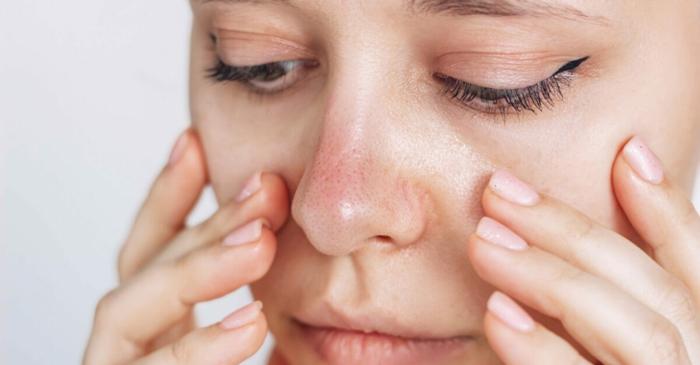 O metodă neașteptată cu un prosop cald elimină punctele negre