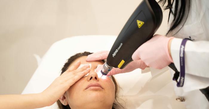 Toamna este perioada ideală pentru tratarea melasmei, spun dermatologii