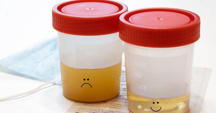 Un simplu test de urină poate detecta riscul de demență cu decenii înainte