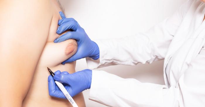 Cancerul de sân afectează și bărbații, fiind depistat adesea în stadii avansate