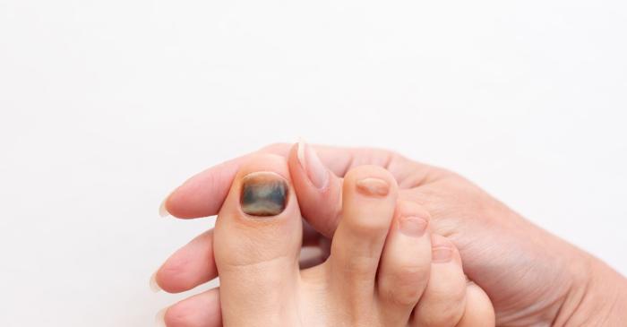 Ce reacții neașteptate poate declanșa efortul fizic în organism?