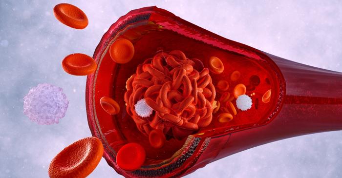 Cinci alimente comune care pot curăța arterele și reduce riscul de infarct