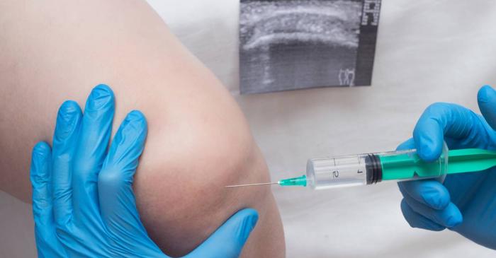 Ozonoterapia reduce inflamația și îmbunătățește oxigenarea tisulară