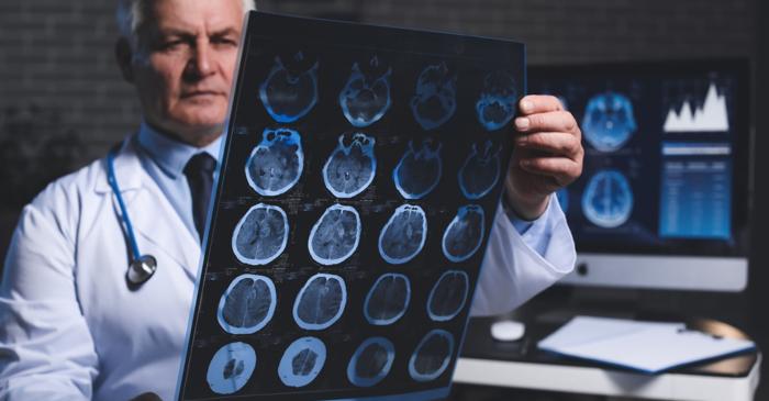 Depresia, nu pierderea memoriei, ar putea fi primul semn al bolii Alzheimer