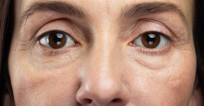 De ce arătăm obosiți chiar și atunci când suntem odihniți?