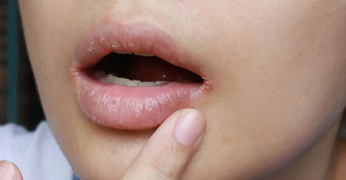 Un scrub cu zahăr și miere vindecă buzele crăpate în doar 30 de secunde