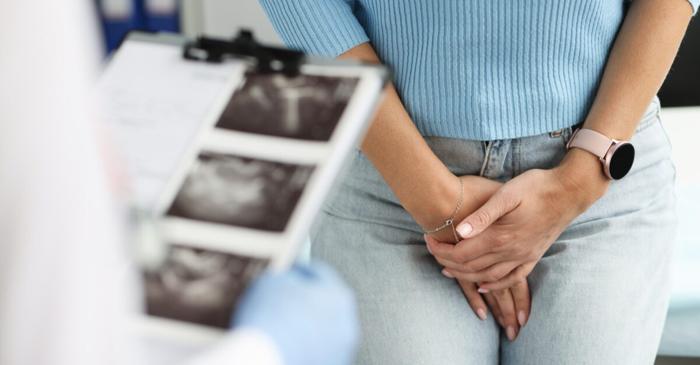 Nevralgia pudendală explică durerea pelvină persistentă la femei