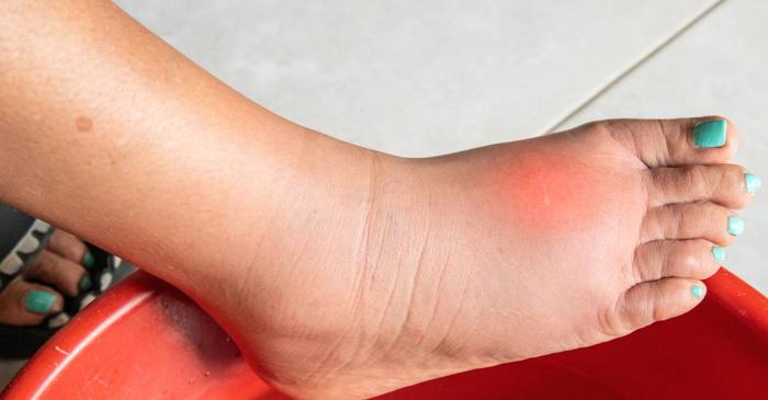 Ceaiul de călin ameliorează crampele menstruale și reduce inflamațiile