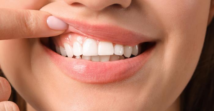 Cum te ajută un ingredient banal din bucătărie să ai un zâmbet mai alb?