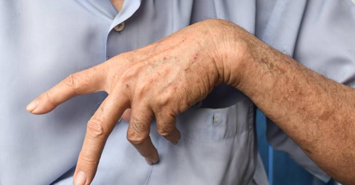 O complicație frecventă a AVC-ului afectează mobilitatea și independența a mii de români