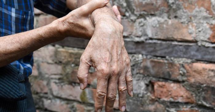 Spasticitatea după AVC afectează până la 40% dintre pacienți în primul an