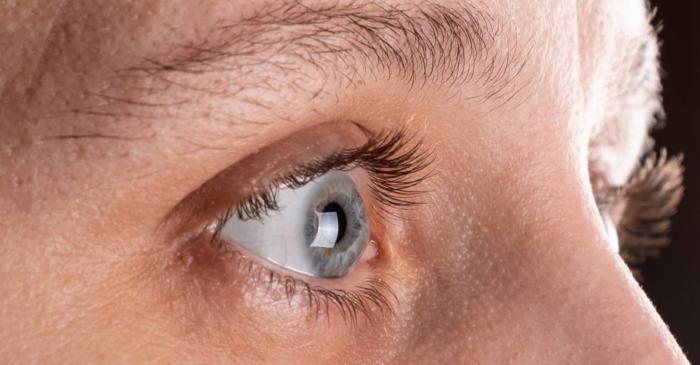 Subțierea sprâncenelor poate indica o deficiență de iod