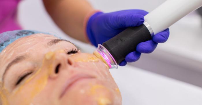 Un protocol în două etape pentru rejuvenarea facială promite rezultate mai durabile decât tratamentele clasice