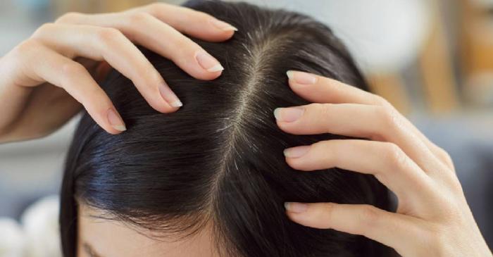 Căderea părului ascunde cauze neașteptate care nu țin de stres sau anotimpuri