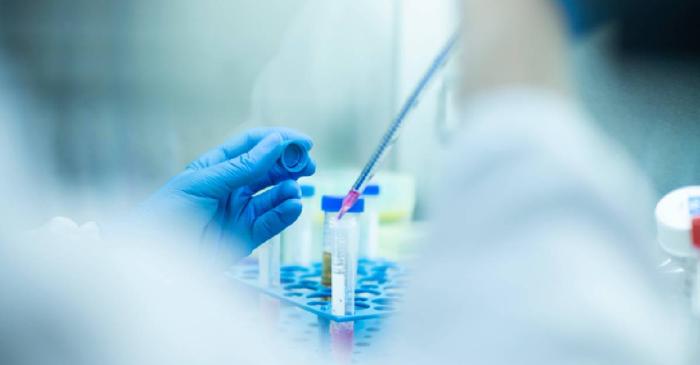 Ce afecțiune mortală poate fi semnalată de îngălbenirea pielii?