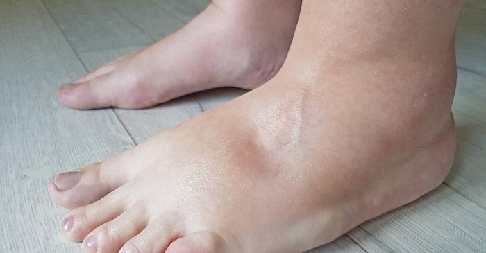 De ce crește greutatea brusc, chiar dacă nu te-ai îngrășat?