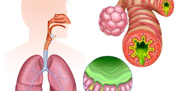 De ce te simți constant obosit fără un motiv aparent?