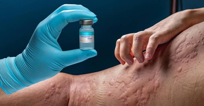 O tânără alergică la zeci de alimente și la apă și-a recăpătat viața datorită unui tratament pentru astm