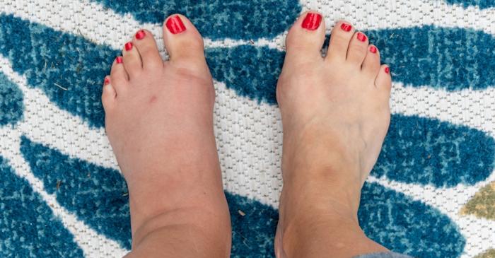 Picioarele pot dezvălui afecțiuni grave, de la diabet la boli cardiace