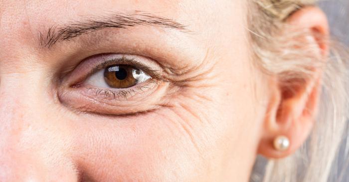 Ridurile reflectă experiențele de viață, nu doar vârsta