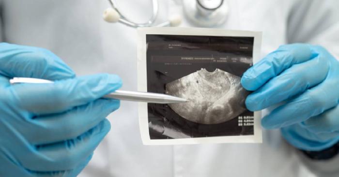 Aproape o treime dintre pacienții cu cancer trăiesc o realitate distorsionată