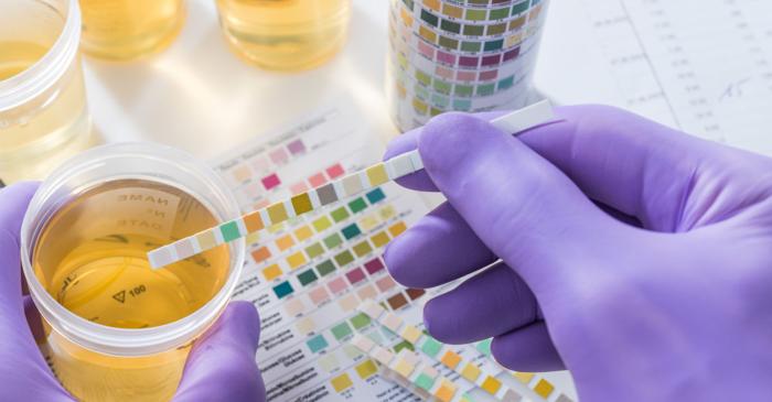 Cum ajung bacteriile intestinale să provoace infecții renale grave?