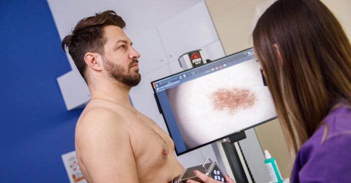 Dermatoscopia digitală descoperă leziunile pe care autoevaluarea pielii le ratează