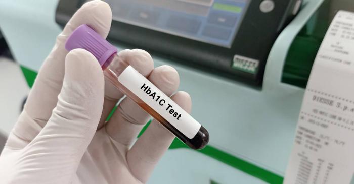 Ai primit un rezultat îngrijorător la testul HbA1c? Anemia feriprivă l-ar putea explica